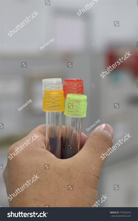 biochemical test tubes bacteria culture hospital stock photo edit