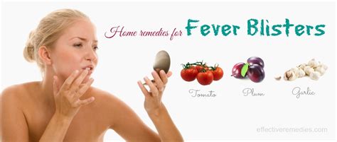 Natural Home Remedies For Fever Blisters On Face In Adults