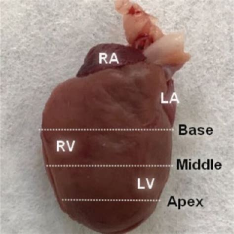 Heart of a normal mouse demonstrating the regions to be analyzed (white