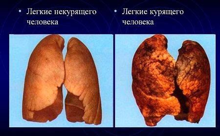 Лечение кашля курильщика - 10 недорогих таблеток