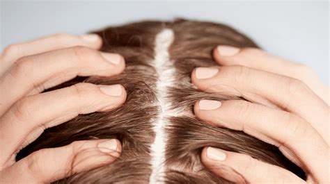 scalp health      explained ameliorate