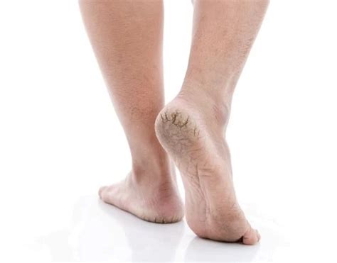 skin soft tissue disorders align foot ankle