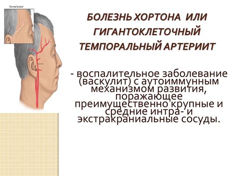 Болезнь Хортона (гигантоклеточный темпоральный артериит) - презентация ...