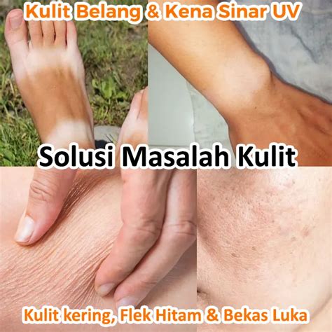 viniera fto alat perkakascom