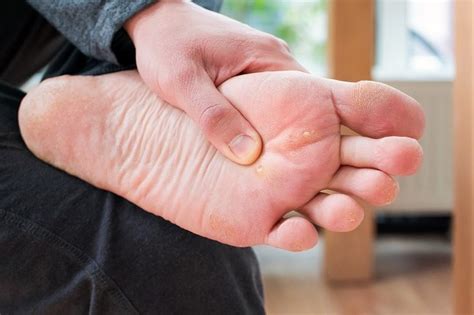 mata ikan gejala penyebab  pengobatan alodokter