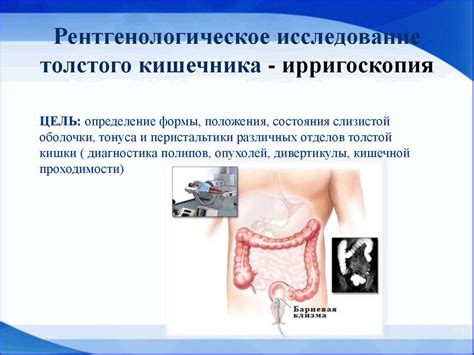 Участие медсестры в подготовке к инструментальным методам исследования ...