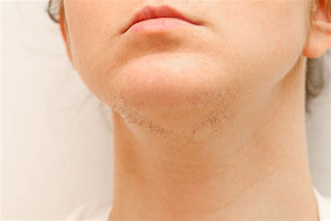 Head and Neck - ReVision MedSpa