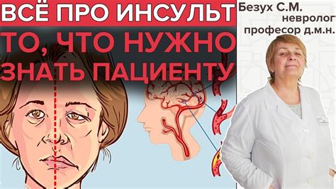 ИНСУЛЬТ | Всё, что нужно знать про инсульты головного мозга - YouTube
