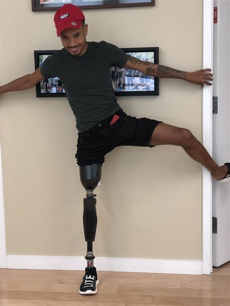 Best Prosthetic For Above Knee Amputation at Russell Chau blog