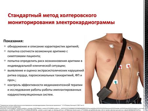 Методы диагностики нарушений сердечного ритма и проводимости ...