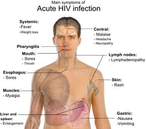 how to know if someone has aids