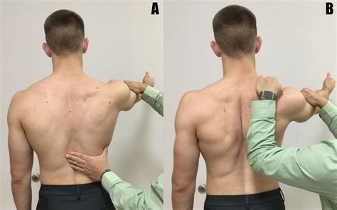 Scapular Control With Flexion Shoulder Scapular Shoulder Rehab