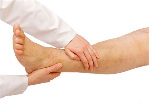 Edema – Symptoms, Causes and Home Remedies