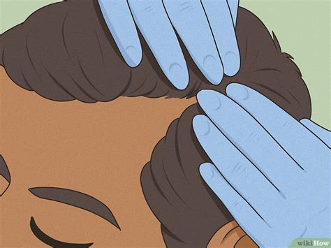How to Tell if Your Hairline is Receding: Signs & Treatment