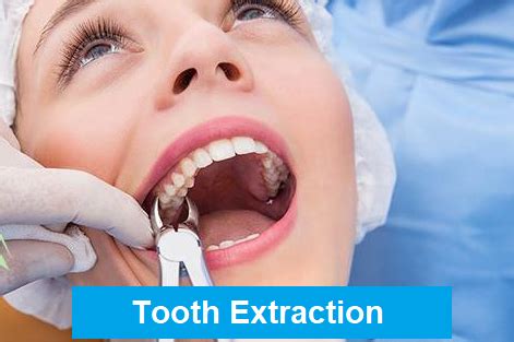 tooth extraction aftercare anoka dental