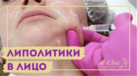 ХУДЕЕМ БЫСТРО | ЛИПОЛИТИКИ В ЛИЦО | Избавляемся от второго подбородка ...