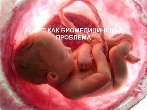 АБОРТ КАК БИОМЕДИЦИНСКАЯ ПРОБЛЕМА АБОРТ — ЭТО