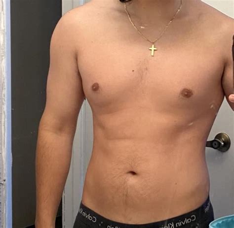 how to know if you have gyno or fat