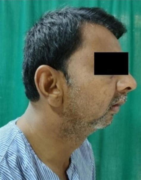 postoperative picture  patient  scientific diagram