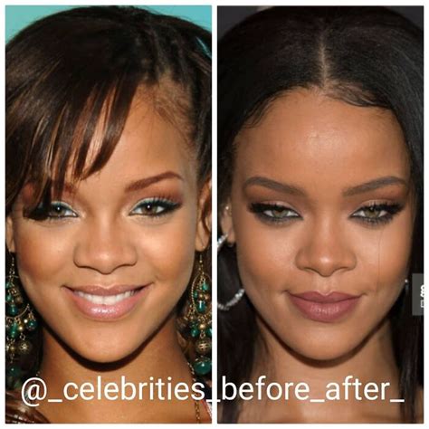 Before And After Celebrity