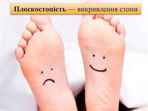 Презентація "Про поставу. Плоскостопість."