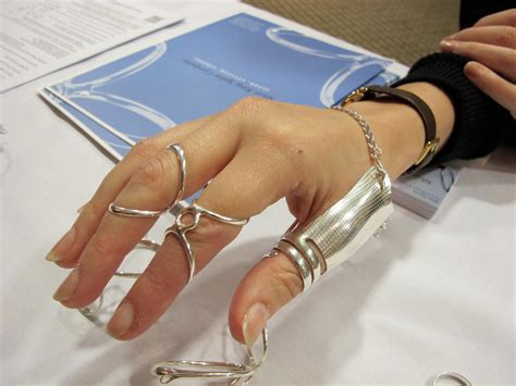 Ring Splints For Ehlers-Danlos Syndrome Hypermobility, 46% OFF
