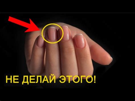 Почему НЕЛЬЗЯ делать МАНИКЮР! Не соверши ошибку… - YouTube