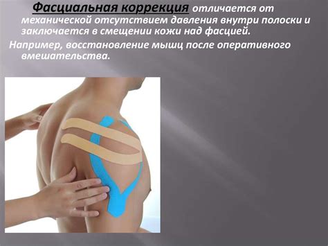Кинезиотейпирование. История кинезиотейпирования - презентация онлайн