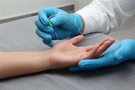 Electromyography (EMG): Uses, Side Effects, Procedure, Results