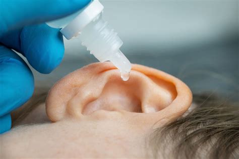 Is it safe to put hydrogen peroxide in your ear? | Miracle-ear