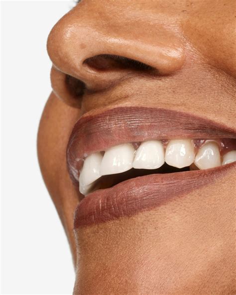 lip line blackhead on lip 5