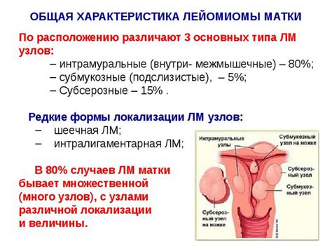 Лейоміома матки: що це таке, небезпека, лікування та видалення