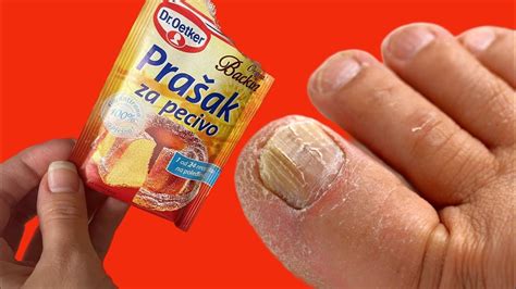 Pin on zdravlje I nega