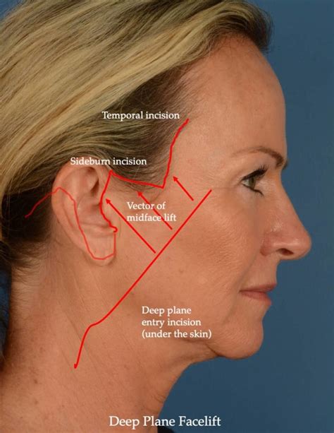 Differences Between Face Treatments- Naples, FL.