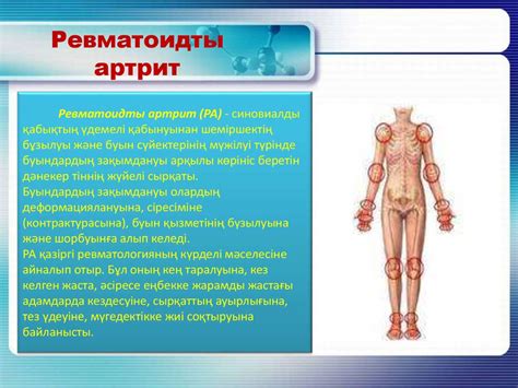 Ревматоидты артрит - презентация онлайн