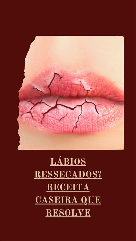 Labios Ressecados O Que Pode Ser - Lábios ressecados: o que pode ser e como aliviar? Confira em Dermaclub ...