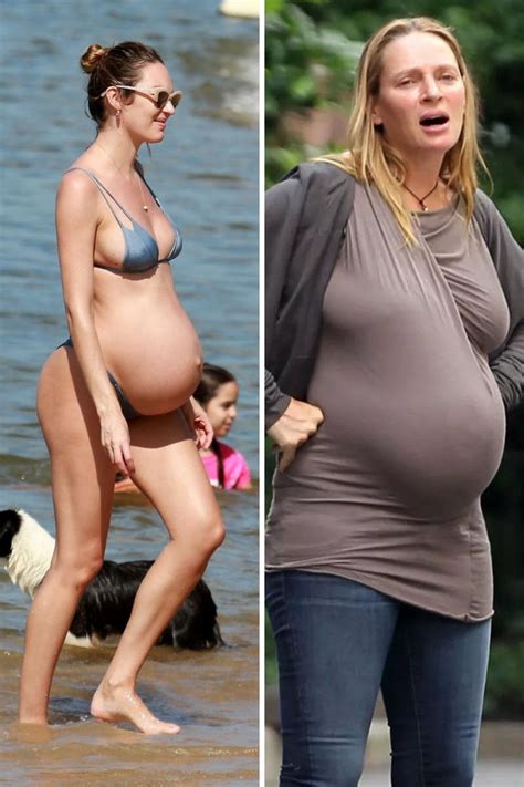 Authentic Testimonials: Women Share Their DIU Pregnancy Journeys