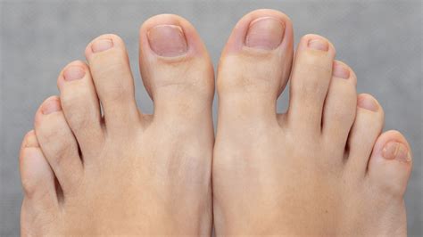 facts  toes factsnet