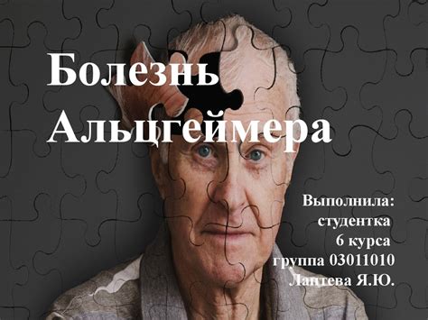 Болезнь Альцгеймера - презентация онлайн