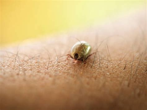 Lyme disease: Serious tick-borne infection that can turn fatal | The ...