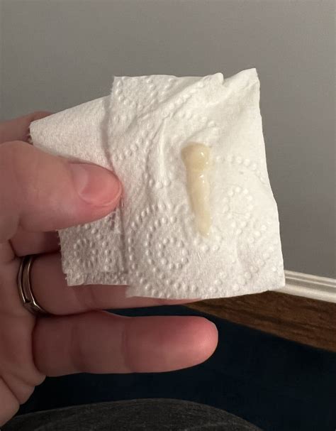 mucus plug graphic image  bump