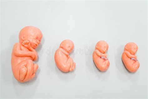 Fetus Stock Photos - Download 10,869 Royalty Free Photos