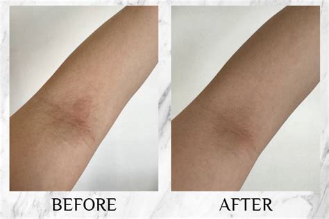 Topicrem DA Emollient Balm Reviews: Honest Readers' Opinions