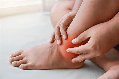 gout ankle huge study shows  gout