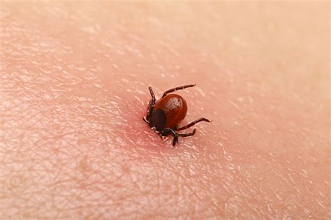 How Long Do Ticks Stay Attached To Dogs