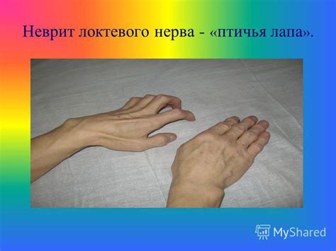 Презентация на тему: "Кафедра нервных болезней с курсом медицинской ...