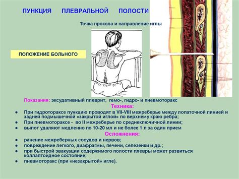 Топографическая анатомия и оперативная хирургия груди - презентация онлайн