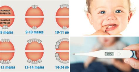 Criança Nascendo Dente Da Febre