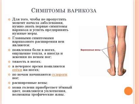 Флеботромбоз. Варикозное расширение вен нижних конечностей ...