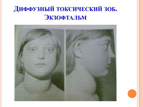 Диагностика сахарного диабета и диффузного токсического зоба - online ...